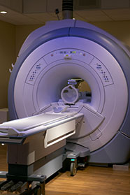 MRI machine with internal aluminum castings